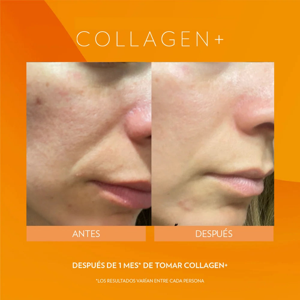 INNER FOCUS COLLAGEN